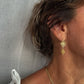 ARETES JARDÍN